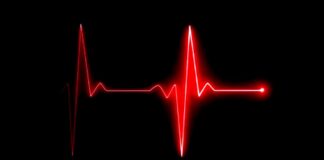 FEBRUARY 2 MY STAR FIVE FOR FRIDAY: FIVE EXAMPLES OF VINTAGE IRON THAT HAVE LEVELED OUT IN PRICE